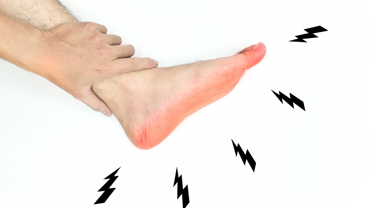 Dor e Formigamento nas pernas ao andar? Saiba o que pode estar por trás ...