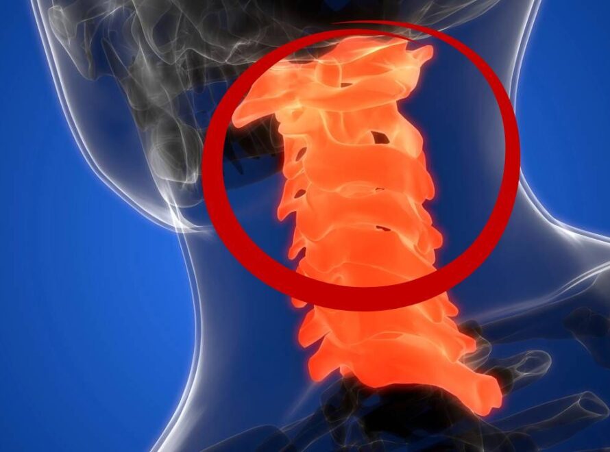Alerta para sintomas que indicam possíveis complicações na cervical