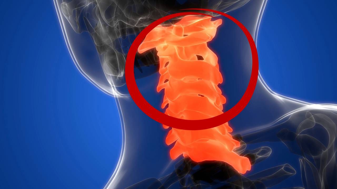 Alerta para sintomas que indicam possíveis complicações na cervical