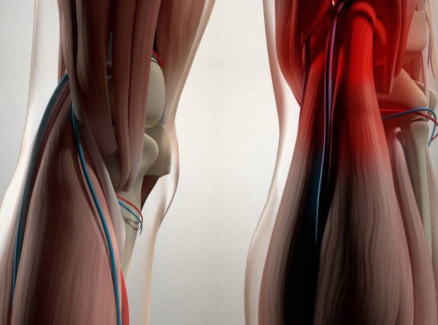 Cartilagem com dor prevendo uma chuva próxima