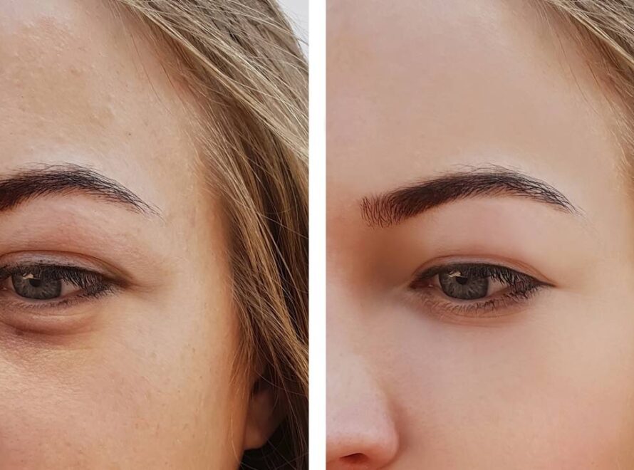 Comparação de inchaço do rosto de mulher