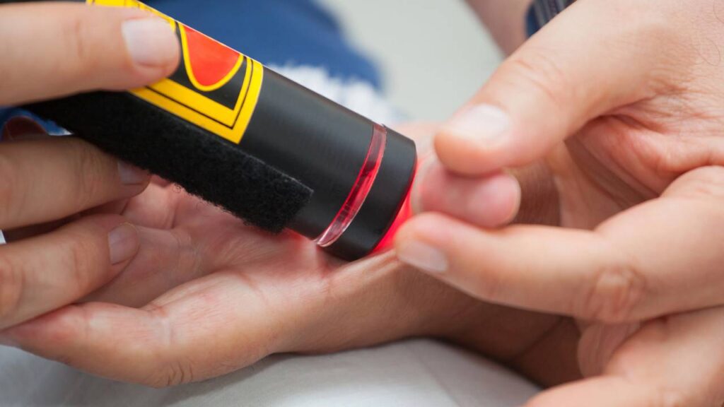 Laserterapia no dedo