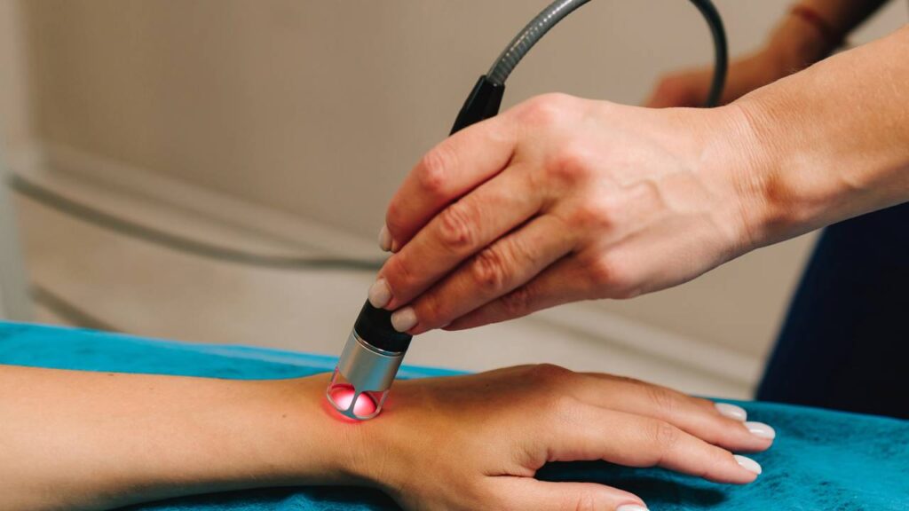 Tratamento ILIB com laser terapia