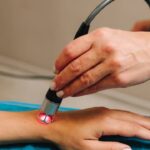Tratamento ILIB com laser terapia
